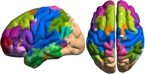 Disrupted modular organization of primary sensory brain areas in schizophrenics